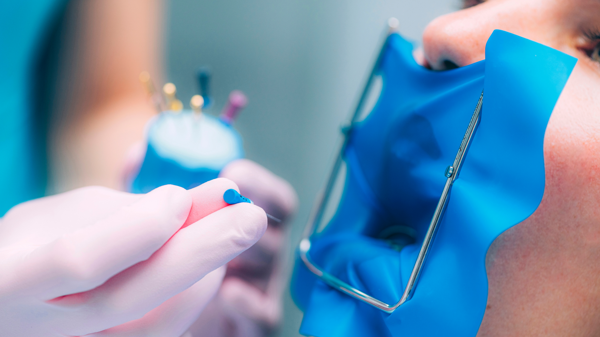 Blog Endodoncia