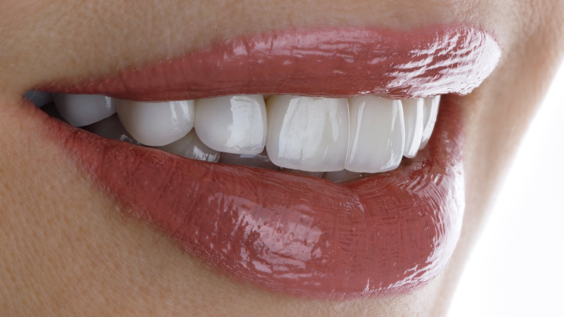 Estética Dental