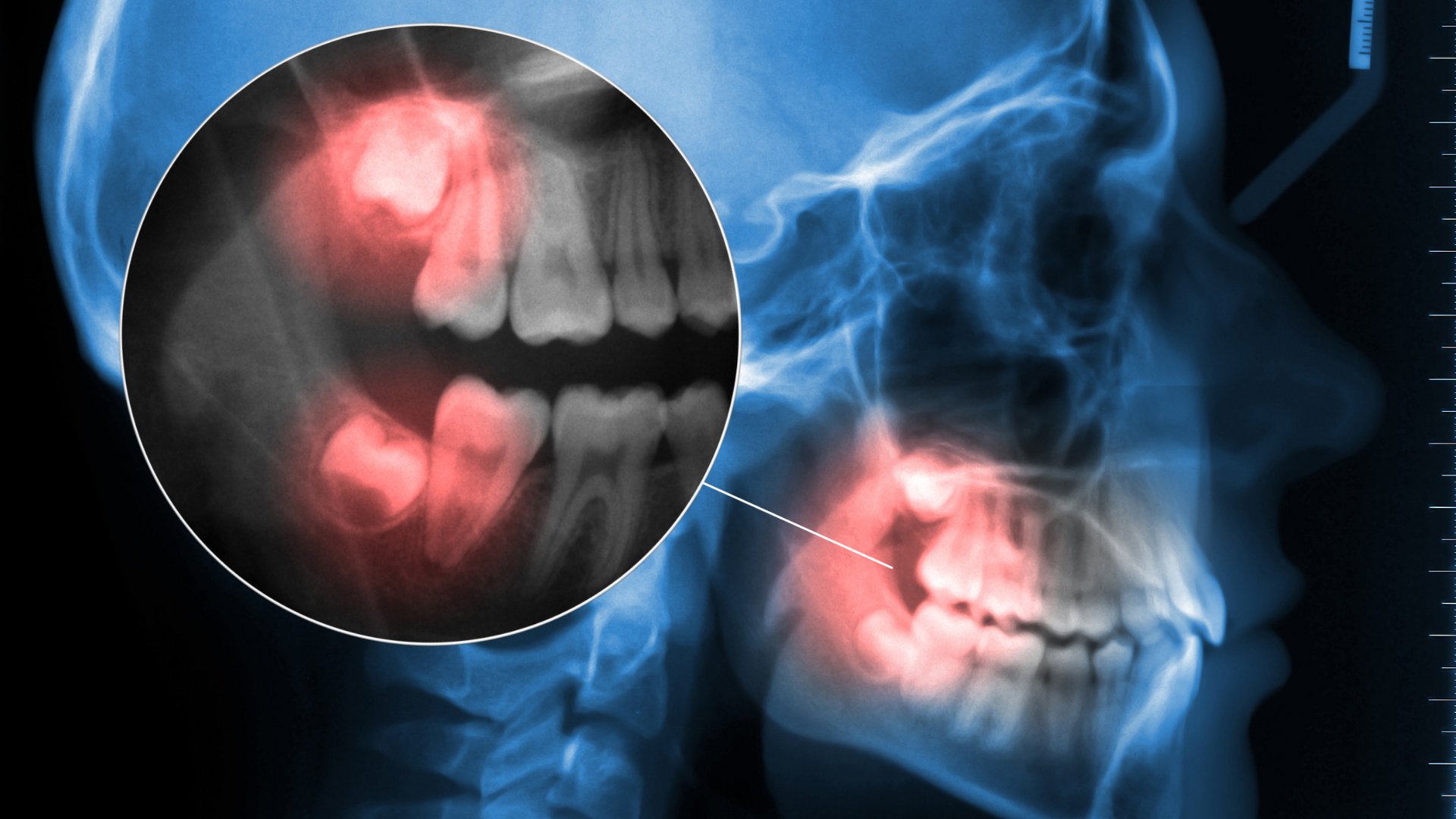Cirugía Maxilofacial